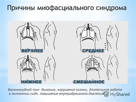 Улучшение удержания дыхания и повышение внутрибрюшного давления