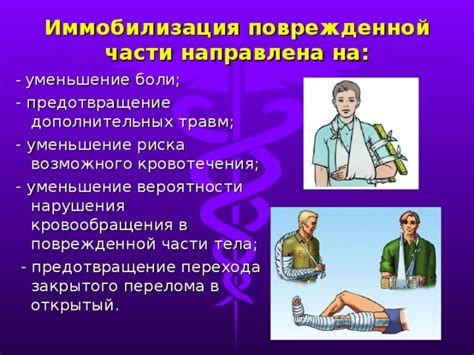 Уменьшение риска производственных травм