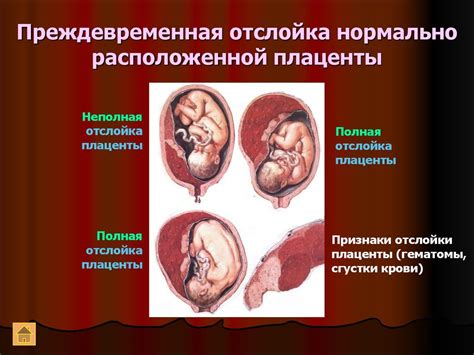 Физиологические аспекты процесса восстановления в раннем послеродовом периоде у младенцев