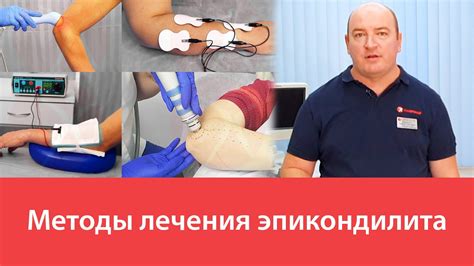 Физиотерапевтические методы лечения эпикондилита