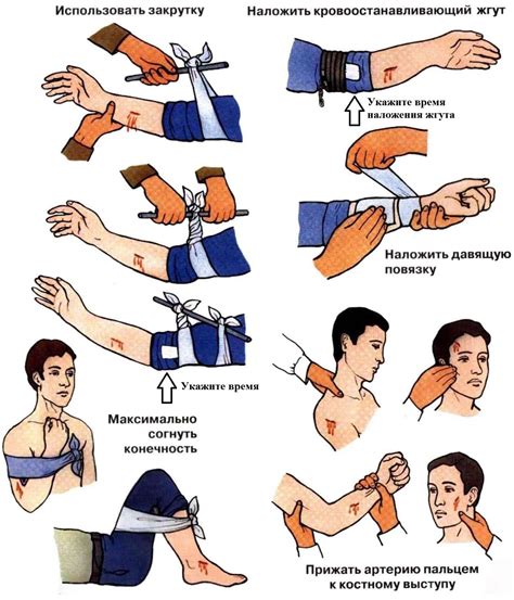 Фиксация раны и контроль кровотечения