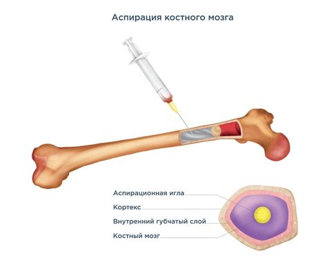 Цель проведения диеты перед процедурой биопсии костного мозга