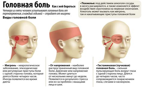 Цефалгия: краткое описание