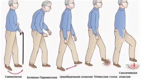 Что вызывает нарушение координации движения и как его преодолеть