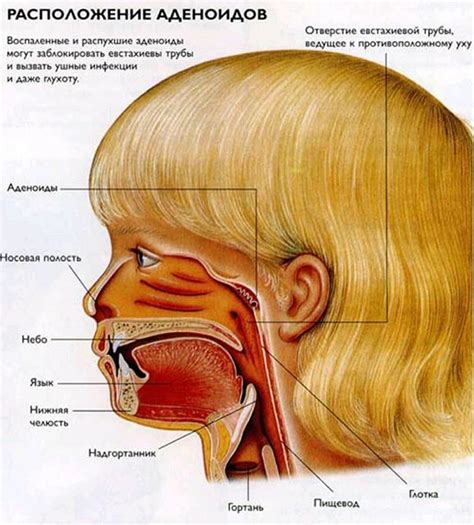 Что такое аденоиды и их функции в организме