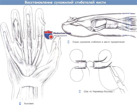 Этапы и особенности восстановления