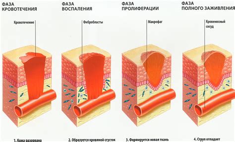 Эффективное заживление раны