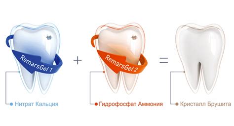 Эффективность применения геля для зубов