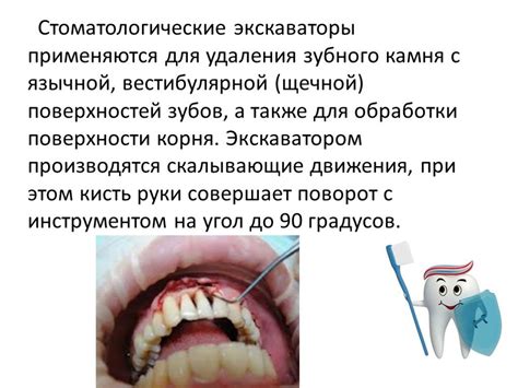  Важность обращения к врачу при неприятных ощущениях после удаления зубных отложений 